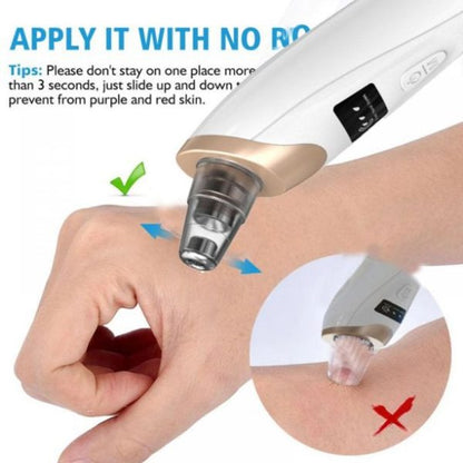 Blackhead Suction Remover Portable Pore Cleaner with LED Display and Multiple Suction Levels
